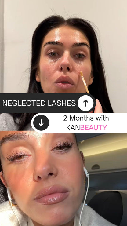 KANBEAUTY - Eyelash Growth Serum for Sensitive Eyes – Prostaglandin-Free, Vegan-Friendly, Natural Ingredients, Peptide-Powered – Visible Results in 3–5 Weeks